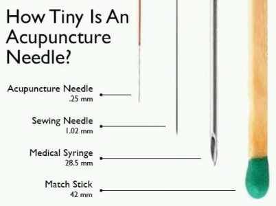 Acupuncture-needle-size.jpg